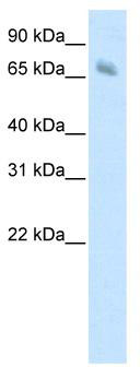 WB Suggested Anti-KBTBD10 Antibody Titration: 1.25 ug/ml; ELISA Titer: 1: 1562500; Positive Control: Human Muscle