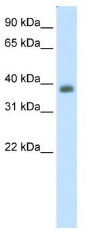 WB Suggested Anti-NEUROD2 Antibody Titration: 0.2-1 ug/ml; ELISA Titer: 1: 1562500; Positive Control: Human cerebellum