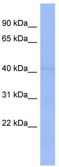 WB Suggested Anti-ZNF193 Antibody Titration: 0.2-1 ug/ml; ELISA Titer: 1: 312500; Positive Control: HT1080 cell lysate