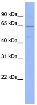 WB Suggested Anti-ARID3B Antibody Titration: 0.2-1 ug/ml; ELISA Titer: 1: 312500; Positive Control: ACHN cell lysate