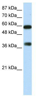 WB Suggested Anti-ARID3B Antibody Titration: 0.2-1 ug/ml; ELISA Titer: 1: 312500; Positive Control: HepG2 cell lysate. ARID3B is supported by BioGPS gene expression data to be expressed in HepG2