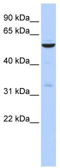 WB Suggested Anti-ZNF266 Antibody Titration: 0.2-1 ug/ml; ELISA Titer: 1: 62500; Positive Control: 721_B cell lysate. ZNF266 is supported by BioGPS gene expression data to be expressed in 721_B
