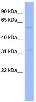 WB Suggested Anti-ZNF266 Antibody Titration: 0.2-1 ug/ml; ELISA Titer: 1: 1562500; Positive Control: HT1080 cell lysate. ZNF266 is supported by BioGPS gene expression data to be expressed in HT1080
