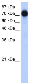 WB Suggested Anti-ZNF16 Antibody Titration: 0.03 ug/ml; ELISA Titer: 1: 1562500; Positive Control: Transfected 293T