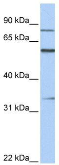 WB Suggested Anti-ZNF16 Antibody Titration: 0.2-1 ug/ml; ELISA Titer: 1: 62500; Positive Control: Human heart