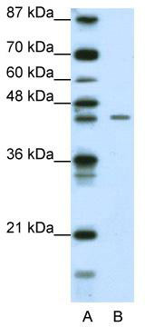 Western blot analysis of extracts of various cell lines, using Septin 1 antibody (TA373091) at 1:1000 dilution.|Secondary antibody: HRP Goat Anti-Rabbit IgG (H+L) at 1:10000 dilution.|Lysates/proteins: 25ug per lane.|Blocking buffer: 3% nonfat dry milk in TBST.|Detection: ECL Basic Kit .|Exposure time: 90s.