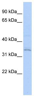 Western blot analysis of extracts of various cell lines, using Septin 4 antibody (TA373093) at 1:1000 dilution.|Secondary antibody: HRP Goat Anti-Rabbit IgG (H+L) at 1:10000 dilution.|Lysates/proteins: 25ug per lane.|Blocking buffer: 3% nonfat dry milk in TBST.|Detection: ECL Basic Kit .|Exposure time: 90s.