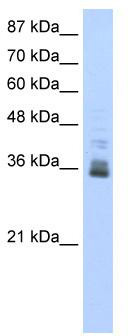 Western blot analysis of extracts of various cell lines, using Septin 5 antibody (TA373094) at 1:3000 dilution.|Secondary antibody: HRP Goat Anti-Rabbit IgG (H+L) at 1:10000 dilution.|Lysates/proteins: 25ug per lane.|Blocking buffer: 3% nonfat dry milk in TBST.|Detection: ECL Basic Kit .|Exposure time: 30s.