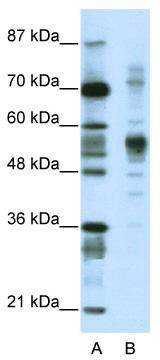 Western blot analysis of extracts of various cell lines, using Septin 11 antibody (TA373098) at 1:3000 dilution.|Secondary antibody: HRP Goat Anti-Rabbit IgG (H+L) at 1:10000 dilution.|Lysates/proteins: 25ug per lane.|Blocking buffer: 3% nonfat dry milk in TBST.|Detection: ECL Basic Kit .|Exposure time: 10s.