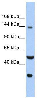 Western blot analysis of extracts of various cell lines, using Septin 12 antibody (TA373099) at 1:1000 dilution.|Secondary antibody: HRP Goat Anti-Rabbit IgG (H+L) at 1:10000 dilution.|Lysates/proteins: 25ug per lane.|Blocking buffer: 3% nonfat dry milk in TBST.|Detection: ECL Basic Kit .|Exposure time: 1s.