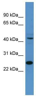 Western blot analysis of extracts of 293T cells, using SARS-CoV-2 3CLpro  antibody (TA373100) at 1:5000 dilution.|Secondary antibody: HRP Goat Anti-Rabbit IgG (H+L) at 1:10000 dilution.|Lysates/proteins: 25ug per lane.|Blocking buffer: 3% nonfat dry milk in TBST.|Detection: ECL Basic Kit .|Exposure time: 180s.