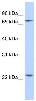 WB Suggested Anti-ZNF185 Antibody Titration: 0.2-1 ug/ml; ELISA Titer: 1: 12500; Positive Control: Hela cell lysate