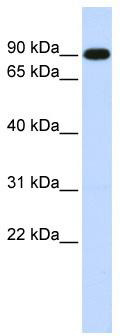 WB Suggested Anti-ZXDA Antibody Titration: 0.2-1 ug/ml; ELISA Titer: 1: 312500; Positive Control: Human Muscle