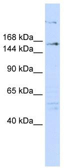 WB Suggested Anti-RERE Antibody Titration: 0.2-1 ug/ml; ELISA Titer: 1: 62500; Positive Control: 293T cell lysate