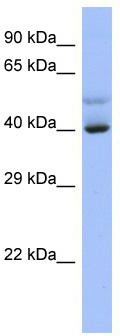 Host: Rabbit; Target Name: SCML4; Sample Tissue: NCI-H226 Whole cell lysates; Antibody Dilution: 1.0 ug/ml