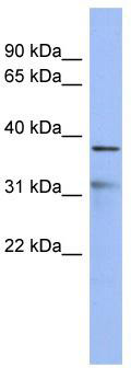 WB Suggested Anti-HEY2 Antibody Titration: 0.2-1 ug/ml; ELISA Titer: 1: 312500; Positive Control: NCI-H226 cell lysate