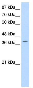 WB Suggested Anti-MYST4 Antibody Titration: 0.2-1 ug/ml; Positive Control: HepG2 cell lysate; There is BioGPS gene expression data showing that KAT6B is expressed in HepG2