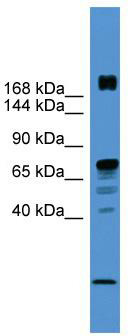 WB Suggested Anti-RLF Antibody Titration: 0.2-1 ug/ml; ELISA Titer: 1: 62500; Positive Control: PANC1 cell lysate