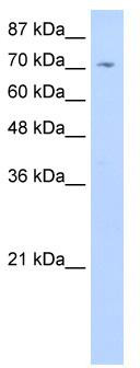 WB Suggested Anti-ZNF214 Antibody Titration: 0.2-1 ug/ml; Positive Control: Jurkat cell lysate