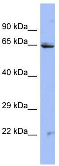 Host: Rabbit; Target Name: ZNF284; Sample Tissue: HT1080 Whole cell lysates; Antibody Dilution: 1.0 ug/ml