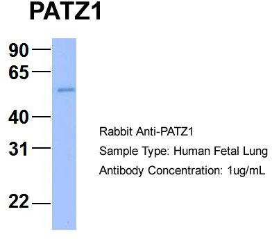 Host: Rabbit; Target Name: PATZ1; Sample Tissue: Human Fetal Lung; Antibody Dilution: 1.0 ug/ml