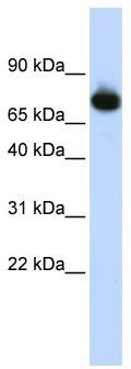WB Suggested Anti-PATZ1 Antibody Titration: 0.2-1 ug/ml; ELISA Titer: 1: 1562500; Positive Control: HepG2 cell lysate; PATZ1 is strongly supported by BioGPS gene expression data to be expressed in Human HepG2 cells