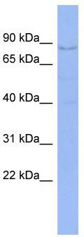 WB Suggested Anti-CNOT3 Antibody Titration: 0.2-1 ug/ml; ELISA Titer: 1: 312500; Positive Control: HT1080 cell lysate