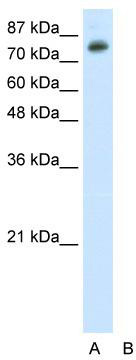 WB Suggested Anti-TSC22D2 Antibody Titration: 0.2-1 ug/ml; ELISA Titer: 1: 12500; Positive Control: HepG2 cell lysate