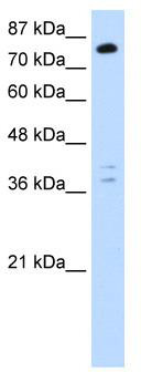 WB Suggested Anti-TSC22D2 Antibody Titration: 0.2-1 ug/ml; Positive Control: Jurkat cell lysate