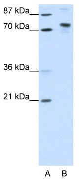 WB Suggested Anti-KIAA0737 Antibody Titration: 1.25 ug/ml; ELISA Titer: 1: 12500; Positive Control: Transfected 293T