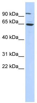 Western blot analysis of extracts of mouse liver, using ACP1 Antibody (TA373205) at 1:1000 dilution.|Secondary antibody: HRP Goat Anti-Rabbit IgG (H+L) at 1:10000 dilution.|Lysates/proteins: 25ug per lane.|Blocking buffer: 3% nonfat dry milk in TBST.