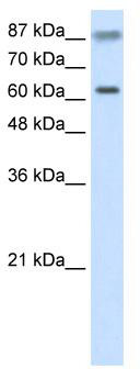 Western blot analysis of extracts of Mouse kidney, using ACP5 antibody (TA373207) at 1:1000 dilution.|Secondary antibody: HRP Goat Anti-Rabbit IgG (H+L) at 1:10000 dilution.|Lysates/proteins: 25ug per lane.|Blocking buffer: 3% nonfat dry milk in TBST.|Detection: ECL Basic Kit .|Exposure time: 5s.