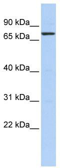 WB Suggested Anti-KLHL5 Antibody Titration: 0.2-1 ug/ml; ELISA Titer: 1: 1562500; Positive Control: Hela cell lysate