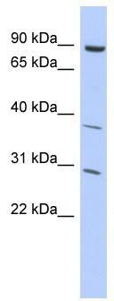 WB Suggested Anti-KLHL5 Antibody Titration: 0.2-1 ug/ml; ELISA Titer: 1: 312500; Positive Control: THP-1 cell lysate