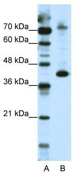 WB Suggested Anti-NKRF Antibody Titration: 2.5 ug/ml; ELISA Titer: 1: 1562500; Positive Control: HepG2 cell lysate