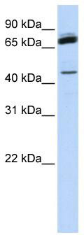WB Suggested Anti-NKRF Antibody Titration: 0.2-1 ug/ml; ELISA Titer: 1: 1562500; Positive Control: Human Muscle