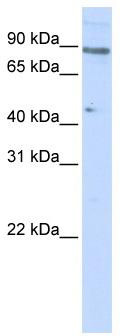 WB Suggested Anti-ZNF280C Antibody Titration: 0.2-1 ug/ml; ELISA Titer: 1: 312500; Positive Control: 293T cell lysate