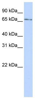 WB Suggested Anti-KLHL26 Antibody Titration: 0.2-1 ug/ml; ELISA Titer: 1: 312500; Positive Control: 721_B cell lysate; KLHL26 is supported by BioGPS gene expression data to be expressed in 721_B