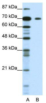 WB Suggested Anti-KLHL26 Antibody Titration: 1.25 ug/ml; ELISA Titer: 1: 1562500; Positive Control: Jurkat cell lysate; KLHL26 is supported by BioGPS gene expression data to be expressed in Jurkat
