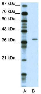 WB Suggested Anti-ZNF444 Antibody Titration: 2.5 ug/ml; ELISA Titer: 1: 1562500; Positive Control: Jurkat cell lysate; ZNF444 is supported by BioGPS gene expression data to be expressed in Jurkat