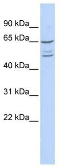 WB Suggested Anti-ZNF415 Antibody Titration: 0.2-1 ug/ml; ELISA Titer: 1: 312500; Positive Control: 293T cell lysate