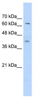 WB Suggested Anti-ZNF415 Antibody Titration: 0.2-1 ug/ml; Positive Control: Jurkat cell lysate