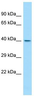 Host: Rabbit; Target Name: Wdr45l; Sample Tissue: Rat Spleen lysates; Antibody Dilution: 1.0 ug/ml