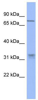 WB Suggested Anti-PRDM8 Antibody Titration: 0.2-1 ug/ml; ELISA Titer: 1: 312500; Positive Control: HT1080 cell lysate