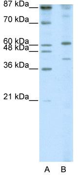 Western blot analysis of extracts of various cell lines, using CHD9 antibody (TA374722) at 1:3000 dilution.|Secondary antibody: HRP Goat Anti-Rabbit IgG (H+L) at 1:10000 dilution.|Lysates/proteins: 25ug per lane.|Blocking buffer: 3% nonfat dry milk in TBST.|Detection: ECL Basic Kit .|Exposure time: 1s.
