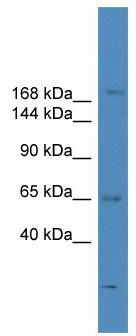 WB Suggested Anti-SCAPER Antibody Titration: 0.2-1 ug/ml; ELISA Titer: 1: 312500; Positive Control: ACHN cell lysate