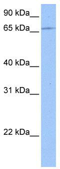 WB Suggested Anti-ZNF317 Antibody Titration: 0.2-1 ug/ml; ELISA Titer: 1: 312500; Positive Control: Jurkat cell lysate