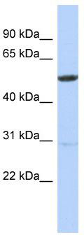 WB Suggested Anti-ZNF529 Antibody Titration: 0.2-1 ug/ml; ELISA Titer: 1: 62500; Positive Control: Jurkat cell lysate; ZNF529 is supported by BioGPS gene expression data to be expressed in Jurkat