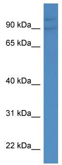 WB Suggested Anti-DMTF1 Antibody Titration: 0.2-1 ug/ml; ELISA Titer: 1: 0; Positive Control: PANC1 cell lysate