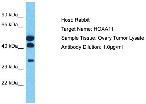 Host: Rabbit; Target Name: HOXA11; Sample Tissue: Ovary Tumor lysates; Antibody Dilution: 1.0 ug/ml